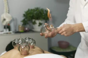 This image is about Cupping Therapy