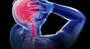 Graphical picture shows suffering form migraine 